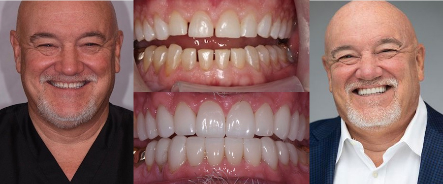 Dr. Eric Farmer Profile See the difference NYC smile design has made for Dr. Eric Farmer