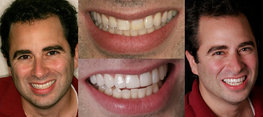 Dr. Jonathan Abenaim Profile See the difference NYC smile design has made for Dr. Jonathan Abenaim