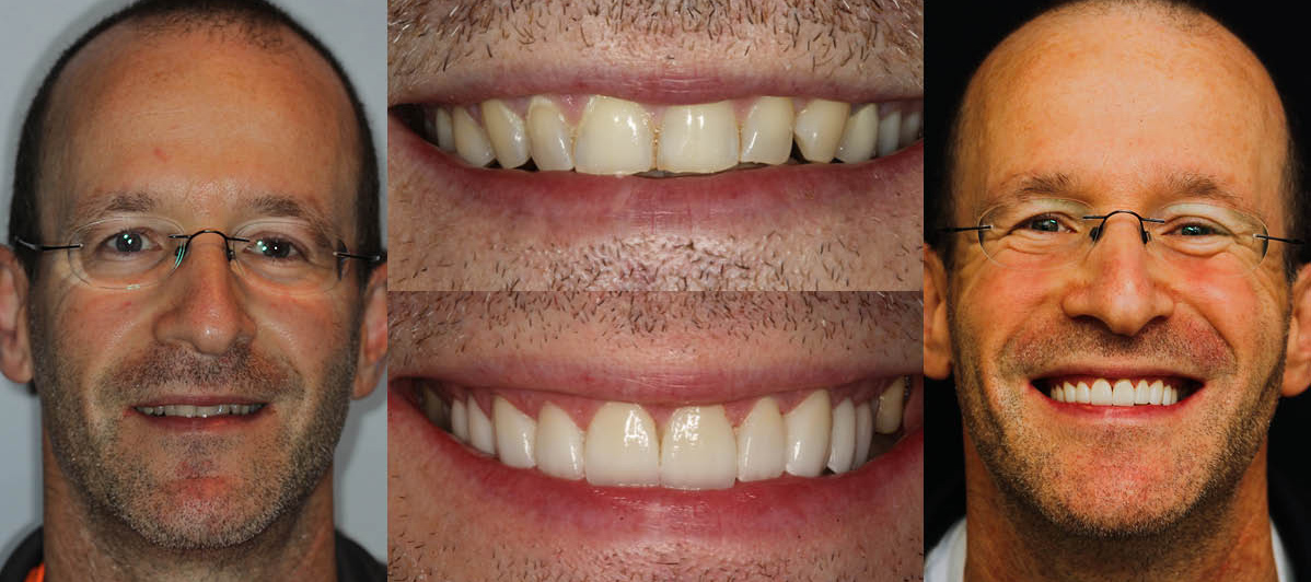 Dr. Anatoliy Ravin Profile See the difference NYC smile design has made for Dr. Anatoliy Ravin