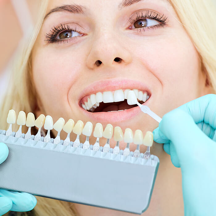 A lady with an open mouth and her teeth is showing while a crown is fitted