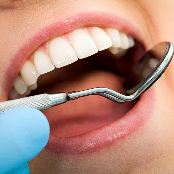 Dental Instrument on a mouth An open mouth showing upper teeth while being examined by a dental instrumen