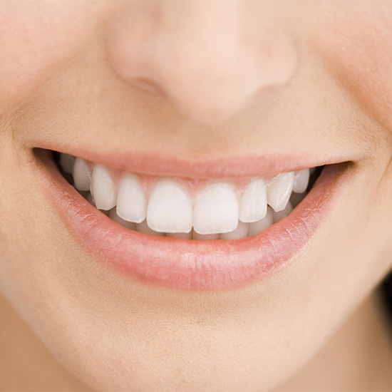 Upper teeth smile A smile showing upper teeth