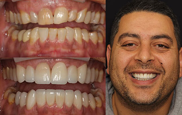 Dan Portrait See the difference NYC smile design has made for Dan