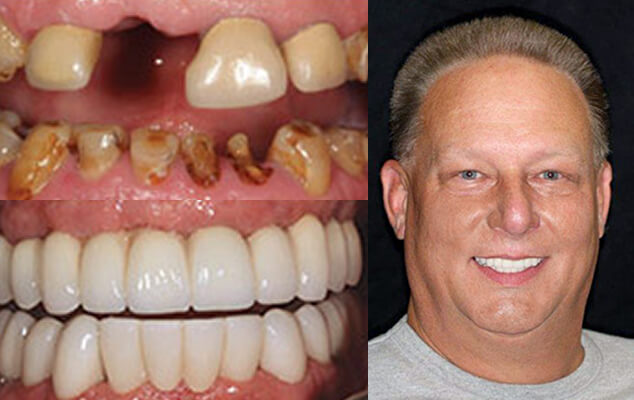 David Portrait See the difference NYC smile design has made for David