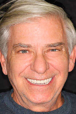 Frank Portrait See the difference NYC smile design has made for Frank