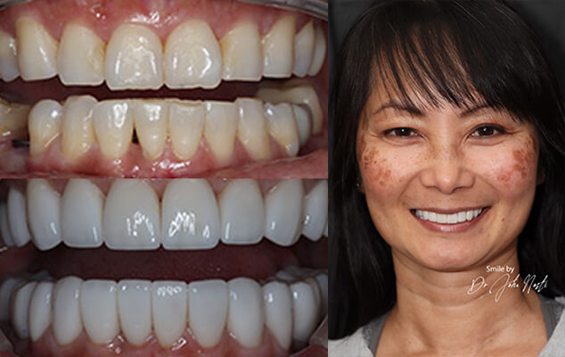 Dr. Mercado Portrait See the difference NYC smile design has made for Dr. Mercado