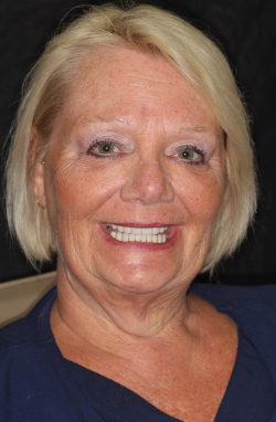 Denise Profile