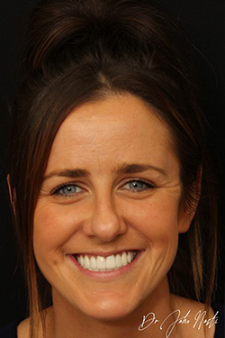 Kate Profile