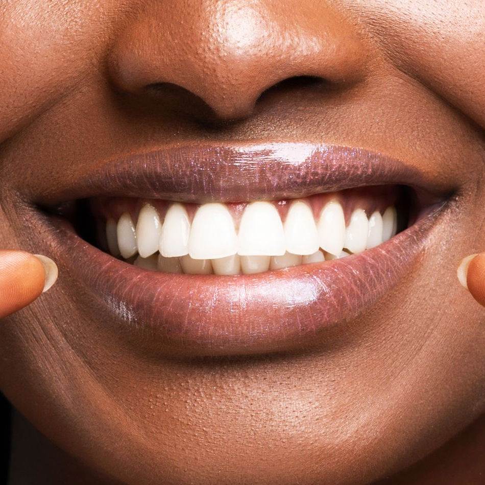 Restore your smile with our periodontal therapy treatment A young lady with long hair and wearing braces