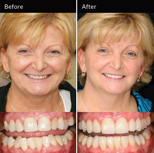 Advanced Cosmetic Dentistry