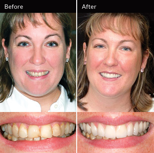Advanced Cosmetic Dentistry